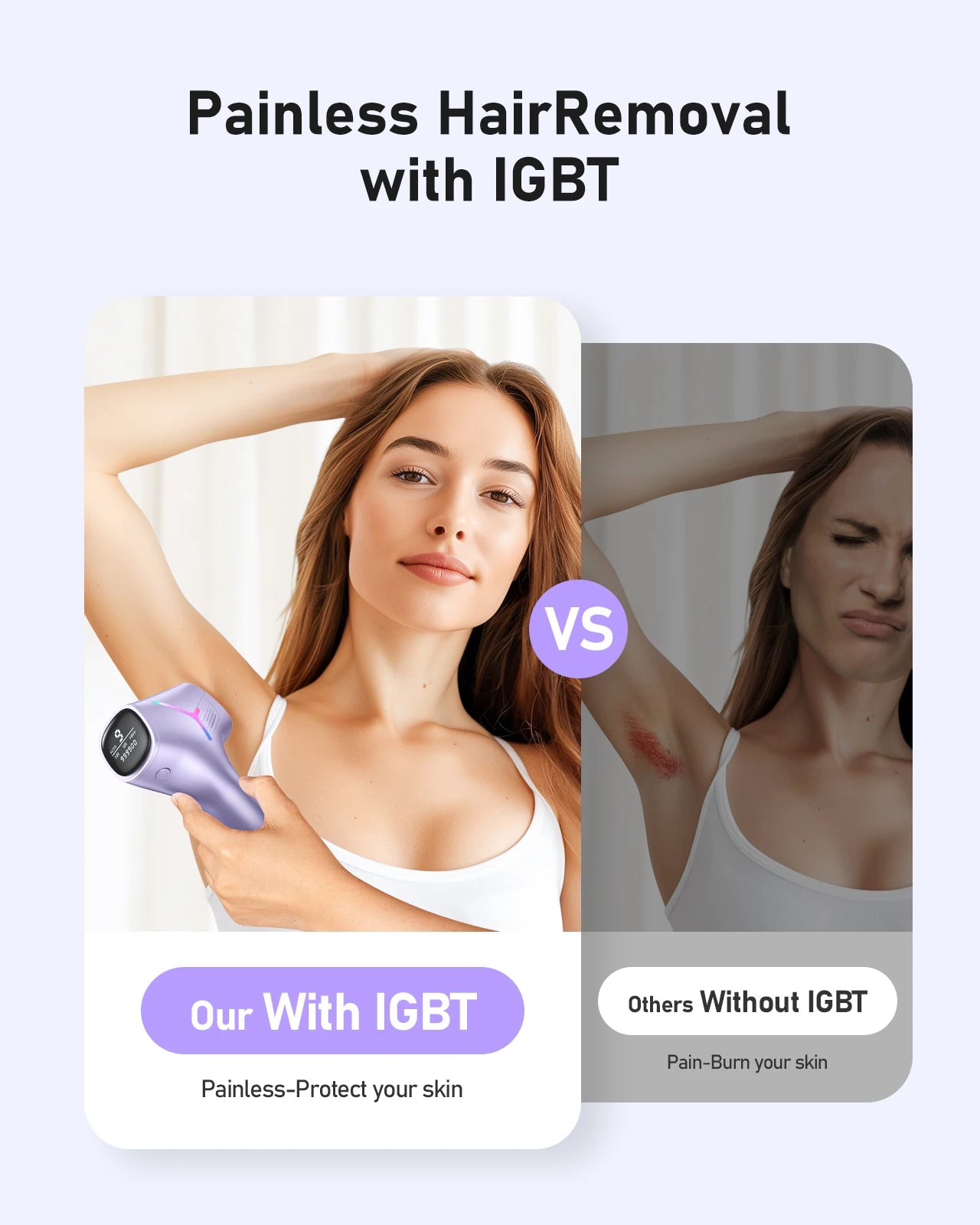 IPL Laser Hair Removal Device – 999,999 Flashes, 9 Levels