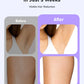 IPL Laser Hair Removal Device – 999,999 Flashes, 9 Levels